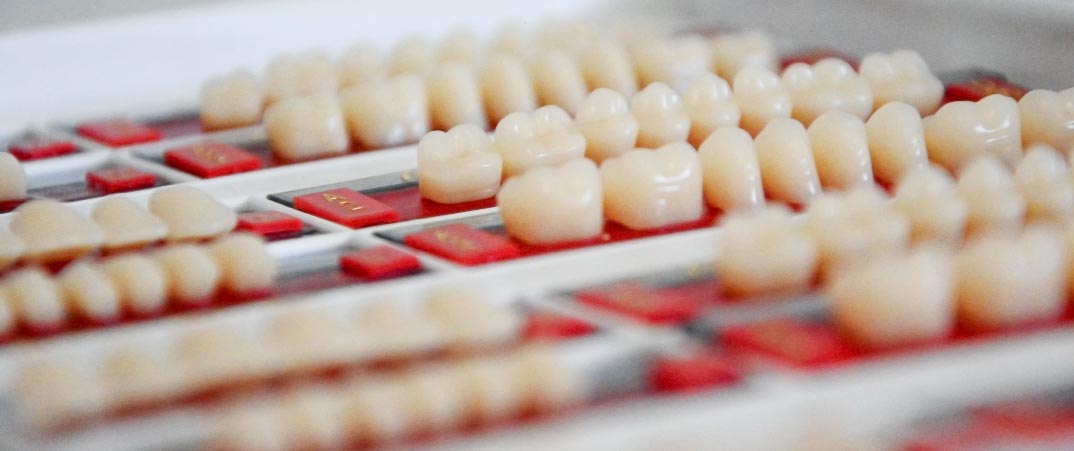 植入物材質不適合特定的患者或特定的植牙情況，可能會導致植牙失敗